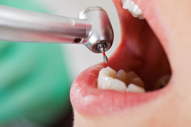 Best Emergency Dental Care for Sports Injuries in Breckinridge Center, KY